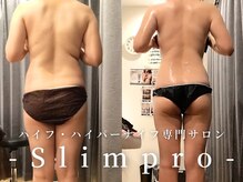 スリムプロ/脊中コース