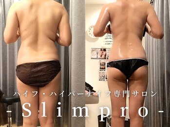 スリムプロ/脊中コース