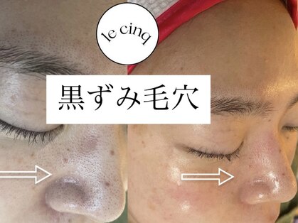 ルサンク(le cinq)の写真