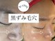 ルサンク(le cinq)の写真