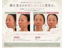 ルアナライフ(Luana Life)
