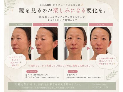 ルアナライフ(Luana Life)の写真