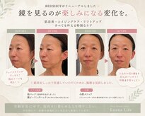 ルアナライフ(Luana Life)