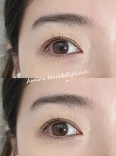 アミーラ(Amira)/フラットラッシュ