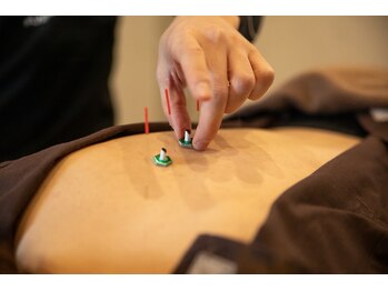 ファノーバ 奥沢店(FUNOVA)/ご希望の箇所への鍼灸