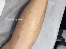 ワクシー 麻布十番店(WAXYYY.)の雰囲気（肌質に合わせたワックスを厳選。いたみの少ない脱毛♪）