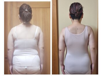 ステラ(Stella)/【痩身】ボディリンパマッサージ