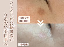 アイ(Ai)の雰囲気(シミケアのビフォーアフターです。美しい肌へと導きます。)