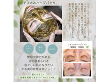 花音の雰囲気（ハーブパック【８～9月限定お試しキャンペーン】詳細はブログへ）