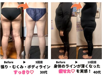 ヨサパーク リノ(YOSA PARK Lino)の写真