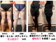 ヨサパーク リノ(YOSA PARK Lino)の写真