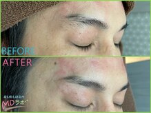 エムディラボ 金沢竪町店(MDラボ)/BeforeAfter