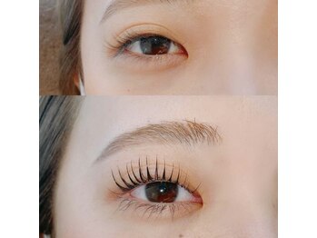 ラプレ(Lapule)/こんなに変わる!