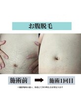 オリオンドットエスツー(Orion.S2)/【Before→After】