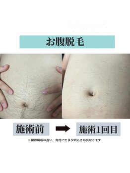 オリオンドットエスツー(Orion.S2)/【Before→After】