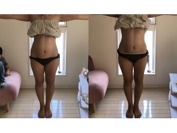 エヌ ドット ジュウイチ(N.11)/産後のママエステ