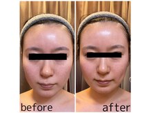 ドクタージェーナ(Dr.Jena)の雰囲気（お顔を小さくしたい方、むくみを取りたい方はお任せ下さい！）