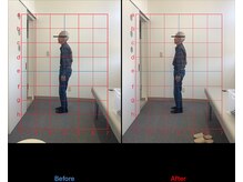 リード整骨院(LEAD整骨院)/腰痛/猫背/姿勢改善/骨盤矯正