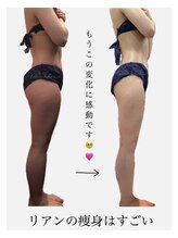 リアン 南熊本店(Lien)/毛穴改善・痩身・ダイエット