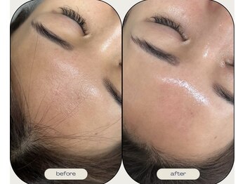 ミミルーチェ(mimiluce)/瞬殺で叶える1日韓国ツヤ肌に◎