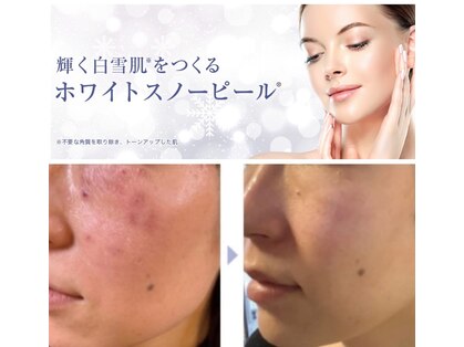 ラージ パトゥ(Raj Path)の写真