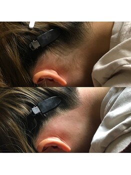 ミヌエット 新宿御苑(Minuet)/うなじダブル