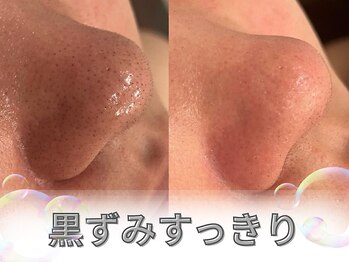 リソルバイスリール(Re:sol by sourire)/毛穴・肌質改善専門店　Re:sol