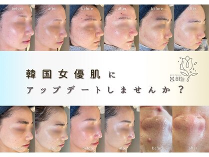 韓国肌管理室pom.haneul【ポムハヌル】LDM/インモード/ララピール/プラピール福岡天神の写真