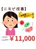 【ニキビ改善】敏感肌向け美肌菌ケアピーリング50分￥15400→