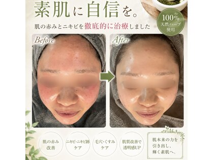 エレ(ele)の写真