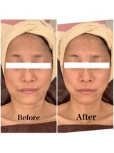 スペチアーレ 夙川/不動の人気No. 1メニュー