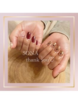 ソナ(Sona)/
