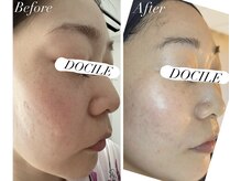 ドシル(DOCILE)/5ヶ月の変化です！