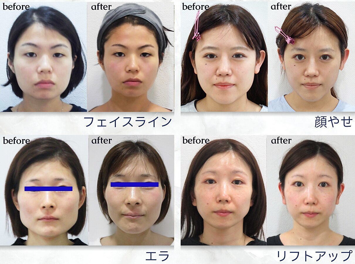 効果即実感小顔・骨盤矯正テクニック
