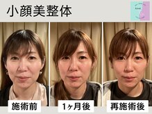 アンドヌーク(&nuuk)の雰囲気（即日効果も◎定期的に続けることで効果持続！痛みない小顔施術◇）