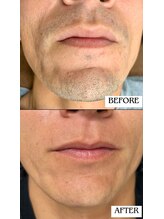 バディーズ(BUDDieS)/30代　