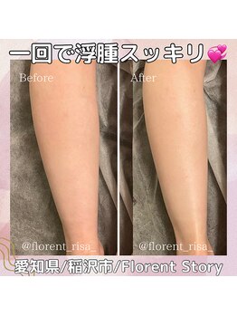 アーキ(ARCHI)/リンパ流し