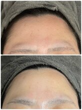 サロンエン(salon Enn)/プラズマニアでの変化！