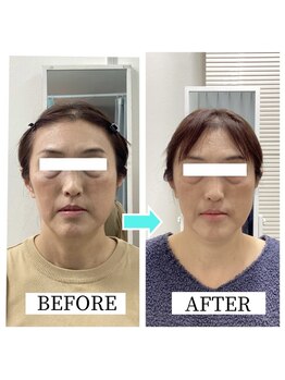 シンメトリー 千葉店/ソフトな施術の小顔矯正