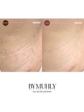 モア(more.)/脇の変化（1回）