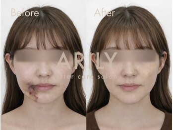 アリリィ(ARILY)/ARILY after care salon