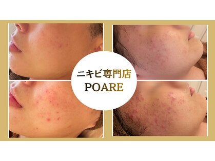 ポアレ(POARE)の写真