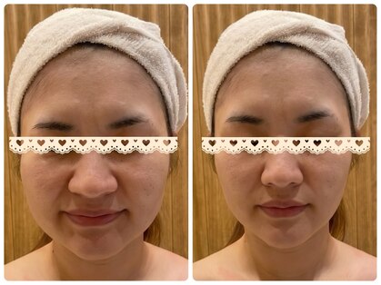 エピファニー(Epi phany Total Beauty Salon)の写真