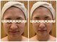 エピファニー(Epi phany Total Beauty Salon)の写真