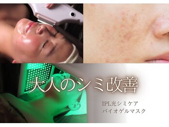 リリー(LILY.)の写真/「濃くなった気がするシミ」を改善！これ以上増やさない予防ケアも◎