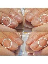 ニコプラス(NICO+)/自爪育成パラジェルクリア補強