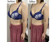 エムエム(mm)/2人出産30代女性/産後バスト