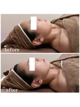 ミツレイ 九条店(MITUREI)/小顔