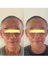 美健家/before⇒after