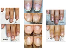 ミリアネイル 成城(Miliea nail)